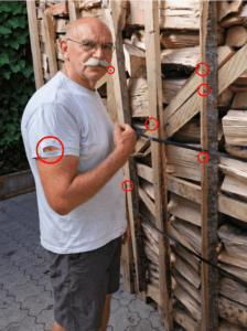 Verletzung am Arm durch herausstehende Schrauben an einer Brennholzpalette von ÖkoBrix